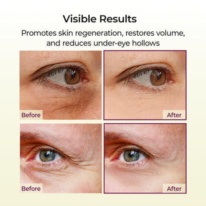 Bálsamo Reafirmante™